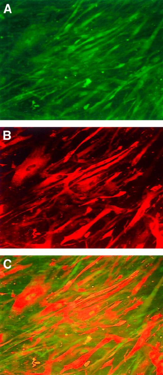 Fig. 1. Immunofluorescence staining of human myotubes transduced with AAV-hF.IX. / (A) Cells are stained with an anti-desmin antibody (detecting antibody is FITC labeled). (B) Anti-factor IX antibody (detecting antibody rhodamine labeled). (C) Co-localization experiment.