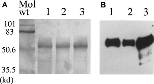 Fig. 2. Purification of myotube-synthesized hF.IX . / (A) 7.5% SDS-PAGE of purified human F.IX. Lane 1, myotube-synthesized hF.IX. Lane 2, HepG2 cell-synthesized F.IX. Lane 3, plasma-derived hF.IX. (B) Western blot of the same gel using a monoclonal antibody to the heavy chain of hF.IX. Lane 1, myotube-synthesized hF.IX. Lane 2, HepG2 cell-synthesized hF.IX. Lane 3, plasma-derived hF.IX (Mononine).