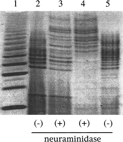 Fig. 5. Fluorophore-assisted carbohydrate electrophoresis (FACE) profiling of sialic acid residues. / (Lane 1) Wheat starch digest control yielding glucose polymers ranging from G3 (lowest band in lane 1) to approximately G15. In lanes 2 to 5, equal amounts of labeled oligosaccharide profile mixtures are loaded after a 24-hour incubation either with (lanes 3, 4) or without (lanes 2, 5) neuraminidase. (Lanes 2, 3) Myotube-synthesized F.IX. (Lanes 4, 5) Human plasma-derived F.IX.