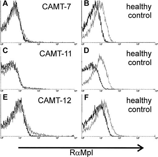 Fig. 3. Expression of c-Mpl on platelets of 2 patients affected from CAMT. / Flow cytometric detection of c-Mpl expression on the surface of platelets from patients CAMT-7 (A), CAMT-11 (C), and CAMT-12 (E) using a polyclonal antiserum against human c-Mpl. Because the flow cytometric measurements were made in different laboratories under slightly different conditions, individual controls from healthy donors are shown for each patient (B,D,F).