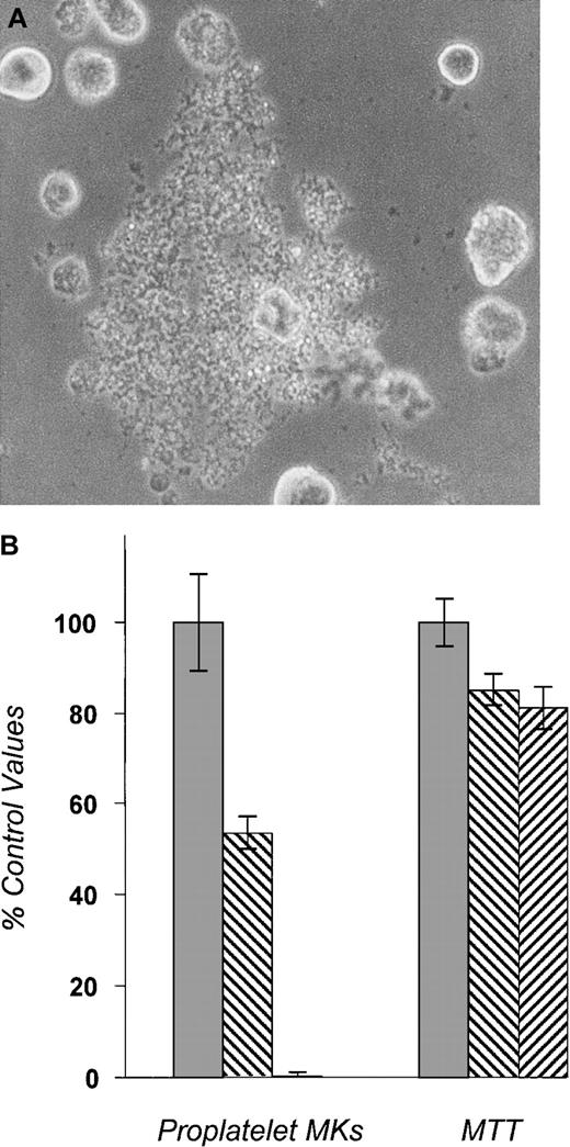 Fig. 1. Proplatelet assay. / Bone marrow cells from BDF1 mice were cultured in TPO-containing media for 72 hours. Mature megakaryocytes (MKs) were purified by unit gravity sedimentation and then cultured in the presence of 10% human plasma for 48 additional hours with or without pharmacologic inhibitors. All experimental conditions contained 50 ng/mL recombinant human TPO. The number of proplatelet-bearing MKs was then enumerated by visual inspection of undisturbed cells. MTT was then added to the culture to reflect the total number of living cells. The data shown are representative results from 3 separate experiments. In each experiment, proplatelet-bearing MK counts were performed in 4 to 5 separate wells per condition tested. (A) A proplatelet-bearing MK. (B) The effects of PKC inhibitors on proplatelet formation. Bis-indolylmaleimide I (500 nmol/L) and prolonged incubation of PMA (100 ng/mL) decreased the number of proplatelet-forming MKs. The numbers of viable MKs measured by MTT assay (shown in the right set of bars) are only modestly affected. ░, DMSO; ▧, BIM 0.5 μM; ▨, PMA 100 ng/mL.