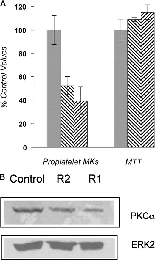 Fig. 3. PKCα-specific ribozymes substantially inhibit proplatelet formation. / (A) The proplatelet assay was performed in the presence of ribozymes R1, R2, or the control ribozyme, which is identical to R1 except that the binding site is present in reverse orientation. The numbers of proplatelet-bearing MKs, expressed as a percentage of the control, were significantly decreased in the presence of R1 and R2. No effect on total cell number was found. The experiments were performed 3 times with similar results. ░, control ribozyme; ▧, R1 ribozyme; ▨, R2 ribozyme. (B) Equal numbers of MKs were transfected with ribozymes. PKCα protein expression was then assessed by Western blot analysis 48 hours after transfection and quantified by phosphoimager. The amount of PKCα expression in R1- and R2-transfected MKs was 25% and 51% of the control, respectively (upper panel). The blot was stripped and reprobed with the ERK2 MAPK antibody to ensure an equal number of cells per lane (lower panel).
