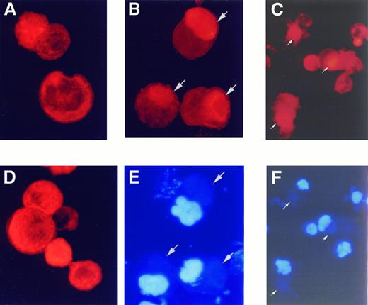 Fig. 4. Actin reorganization during proplatelet formation. / The distribution of polymerized MK actin was investigated after cytocentrifugation by staining with rhodamine-conjugated phalloidin (red) and examining by fluorescent microscopy. (A) In the absence of plasma, polymerized actin is evenly distributed throughout the cells, and there is no proplatelet formation as determined from visual inspection of undisturbed cultures before cytocentrifugation. (B) In plasma-containing cultures that promote proplatelet formation, there are F-actin aggregates in the cells (arrows). These aggregates are not nuclei, as demonstrated by DAPI staining of cells in the same field to show nuclear DNA in blue (E). (C) F-actin staining in proplatelet-forming MKs. MKs grown in 10% plasma were fixed in culture with 2% paraformaldehyde to preserve proplatelet processes before cytospin preparation. At 48 hours, F-actin aggregations can be found in proplatelet-forming MKs (arrows). (D) PKC down-modulation by prolonged incubation of PMA prevented actin reorganization in plasma-containing culture, but did not reduce the amount of F-actin. (F) Nuclear DNA staining of cells in panel C was revealed by DAPI staining.