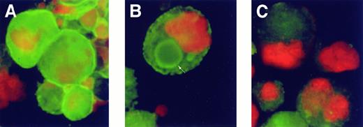 Fig. 6. PKC isoform translocation in response to plasma. / Purified MKs were cultured in TPO either without plasma, with plasma, or with plasma and 100 ng/mL PMA for 48 hours; stained; and examined by immunofluorescent microscopy. PKC isoform α was labeled with FITC-conjugated specific antibodies (green), and nuclear DNA was labeled by propidium iodide (orange). (A) In the absence of plasma, PKCα was distributed throughout the cells with bright-green staining of the cell periphery. (B) In the presence of plasma, when MKs were forming proplatelets, PKCs were localized as a ring-like pattern (arrow) and peripheral staining was reduced. (C) Prolonged incubation with PMA down-modulated PKCα expression and prevented formation of this pattern of PKC distribution.