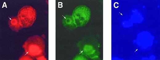 Fig. 7. PKCα colocalizes with actin aggregate. / After incubation with plasma for 48 hours, cells were triply stained with (A) rhodamine-conjugated phalloidin for F-actin (red), (B) anti-PKCα (green), and (C) DAPI (blue) for nuclear DNA. PKCα was found to be colocalized with F actin aggregations (arrow), but not the nuclei.