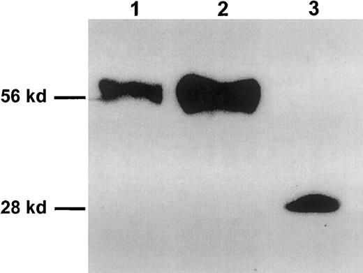 Fig. 1. Visualization of natural and recombinant soluble forms of the membrane-bound γc by Western blot. / Lane 1: naturally occurring sγc concentrated and purified from serum of BALB/c mice by affinity chromatography using the 4G3 mAb. Lane 2: Rsγc (255N-Stop-sγc) expressed in 293/EBNA cells. Lane 3: Rsγc expressed in E coli. Molecular mass markers are indicated on the left.