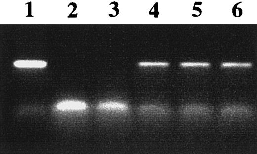 Fig. 2. Transcription of γ chain in transfected cells. / Total cellular RNA was isolated from cells cotransfected with FcαR and WT or altered γ-chain cDNA. The presence of γ-chain message was detected by RT-PCR using γ-chain–specific primers, as described in “Materials and methods.” The γ-chain–specific PCR product was detected as shown in lane 1 (γ-chain cDNA+ control), lane 4 (FcαR + WT γ chain), lane 5 (FcαR + IIA ITAM γ chain), and lane 6 (FcαR + Y → F γ chain). The γ-chain–specific product was not detected when RNA was not added (lane 2) or with parent IIA1.6 cells (lane 3).