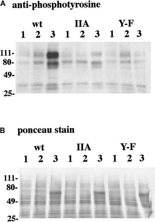 Fig. 6. Tyrosine phosphorylation after FcαR cross-linking is reduced in transfectants with altered γ chain. / (A) Transfectants expressing FcαR and either WT γ chain (WT), γ chain with IIA ITAM (IIA), or γ chain with Y → F mutation (Y → F) were treated as follows: (1) medium, (2) anti-mIgM, and (3) anti-FcαR IgM mAb + anti-IgM. Tyrosine phosphorylation in whole-cell lysate was detected by SDS-PAGE and Western blot analysis with antiphosphotyrosine. Three separate experiments yielded similar results. (B) Prior to immunoblotting with antiphosphotyrosine, the same nitrocellulose membrane shown in panel A was stained with ponceau red to ascertain equivalent loading. Details of the above are described in “Materials and methods.”