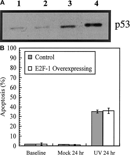 Fig. 4. Effect of DNA damage on p53 and apoptosis in E2F-1–overexpressing cells. / DNA damage upregulates p53 and induces apoptosis in E2F-1–overexpressing cells. (A) p53 immunoblot. Cells were exposed to UV irradiation (25 J/m2) or camptothecin (1-hour pulse, 100 mM) in the presence of IL-3 and then washed extensively and cultured for a further 11 hours in IL-3 medium. Lane 1 shows cells at baseline; lane 2, cells after 12 hours' culture in IL-3 with 0.05% dimethyl sulfoxide, 3 to 12 hours after UV irradiation and 4 to 11 hours after being pulsed with camptothecin. (B) Cells were cultured in IL-3 medium, washed, and resuspended in 10% FBS/phenol-free RPMI for irradiation (10 J/cm2). Cells were then cultured for a further 24 hours in IL-3 medium. As a mock treatment, cells were not irradiated. Cell cycle analysis was performed by flow cytometry.