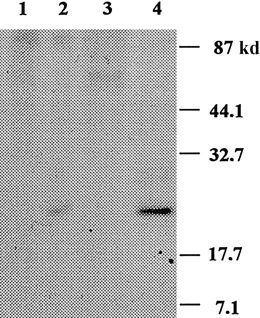 Fig. 8. SDS-PAGE analysis of IL-6 immunoprecipitates of ECCM. / Control immunoprecipitation with normal rabbit serum (lanes 1, 3) and IL-6 immunoprecipitation with an antihuman IL-6 rabbit polyclonal antibody (lanes 2, 4) under nonreducing (lanes 1, 2) and reducing (lanes 3, 4) conditions. Samples were analyzed on an SDS–12% polyacrylamide gel. The positions of molecular weight markers are indicated on the right.
