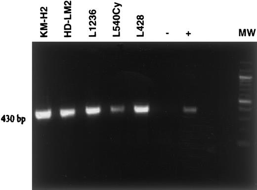 Fig. 3. IL-13Rα1 expression by HL cell lines. / The cDNA was prepared from HL cell lines (KM-H2, HD-LM2, L1236, L540Cy, and L428) and amplified by PCR using IL-13Rα1–specific oligonucleotides, followed by agarose gel electrophoresis. The presence of the 430-bp PCR product indicates IL-13Rα1 gene expression in all 5 HL cell lines examined. Negative control (−): H20; positive control (+): cDNA from BL-31 cells. MW = 100-bp ladder.