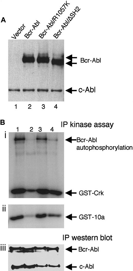 Fig. 1. Expression and kinase activity of wt Bcr-Abl and the SH2 mutants. / (A) Equal amounts of total lysates of NIH3T3 cells transduced with titer-matched viruses carrying gfp alone (lane 1),bcr-abl (lane 2), bcr-abl/R1057K (lane 3), orbcr-abl/ΔSH2 (lane 4) were analyzed by immunoblotting with anti-Abl antibody, Ab-3. The positions of Bcr-Abl and the endogenous c-Abl are indicated. (B) Bcr-Abl (lane 1), kinase-deficient Bcr-Abl/K1176R (lane 2), Bcr-Abl/R1057K (lane 3), and Bcr-Abl/ΔSH2 (lane 4) were transiently expressed in 293T cells, immunoprecipitated with an anti-Abl antibody (Ab-3), and subjected to an in vitro kinase assay using substrate GST-Crk (i) or GST-10a (ii) as well as immunoblotting with the anti-Abl antibody (iii).