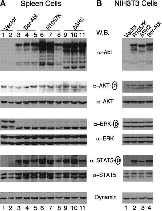 Fig. 7. Expression of Bcr-Abl proteins and activation of Akt, Erk, and STAT5 in vivo and in vitro. / Western blot analyses of spleen cell lysates from 2 vector mice (lanes 1,2), 3 wt Bcr-Abl mice (lanes 3-5), 3 Bcr-Abl/R1057K mice (lanes 6-8), and 3 Bcr-Abl/ΔSH2 mice (lanes 9-11) (A) and of lysates of NIH3T3 cells transduced with titer-matched viruses carrying vector alone (lane 1), bcr-abl/R1057K (lane 2), bcr-abl/ΔSH2 (lane 3), or wt bcr-abl (lane 4) (B). The NIH3T3 cells were serum-starved for 12 hours 2 days after transduction. Equal amounts of total lysates of either spleen cells or NIH3T3 cells were separated on 6% to 15% polyacrylamide gradient gels, transferred to nitrocellulose filters, and probed with antibodies as indicated. The fresh filters were first probed with an anti-Abl antibody (Ab-3) or the phospho-specific antibodies against activated Akt, Erk, and STAT5 and then stripped and reprobed with an anti-Dynamin antibody or antibodies against corresponding Akt, Erk, and STAT5 proteins, respectively.