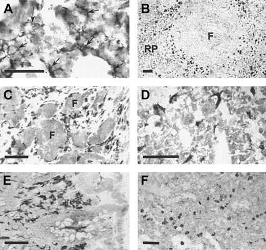 Fig. 7. Sn is expressed specifically on resident macrophages in various human tissues. / Cryostat sections measuring 6 μm from bone marrow (A), spleen (B), reactive lymph node (C), liver (D), colon (E), and lung (F) were stained immunocytochemically with HSN1 mAb. Macrophage populations were stained specifically in all tissues. In bone marrow (A), the stellate processes of resident bone marrow macrophages (arrows) are evident. In the spleen (B), strong staining is present on perifollicular macrophages with weaker staining in the red pulp (RP). Tingible body macrophages within the follicle (F) are not labeled. In reactive lymph node (C), sinusoidal perifollicular macrophages are intensely stained, but no labeling is seen in the follicles (F). In the liver (D), the sinus lining Kupffer cells are labeled. In the colon (E), macrophages in the lamina propria are intensely labeled. In the lung (F), alveolar and interstitial macrophages are positive for Sn. Bars correspond to 50 μm (A) or 100 μm (B-F).