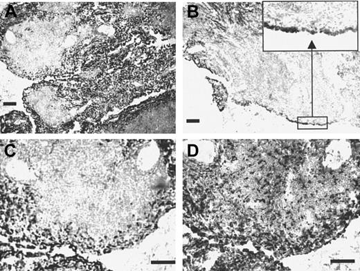 Fig. 8. Sn is expressed on inflammatory macrophages in rheumatoid synovial membrane. / Cryostat sections of rheumatoid synovial membrane measuring 8 μm were stained immunocytochemically with the mAb HSN1 (A-C) or with the antimacrophage marker CD68 (D). Most cells expressing Sn are located in the intima (inset to panel B), which contain a large proportion of CD68+ macrophage-like synoviocytes. In contrast, little if any Sn staining is seen within the T- and B-cell–rich extralymphoid follicles, despite the presence of large numbers of CD68+macrophages pervading the tissue (D). Bars correspond to 100 μm.