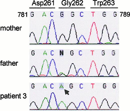 Fig. 4. Sequence analysis of the GTGT-containing allele of. / NCF-1 (exon 8) in genomic DNA of patient 3.Amplification and sequencing of the GTGT-containing allele revealed a G784 → A mutation in patient 3 (arrow). The mutation changes codon 262 from GGC to AGC (Gly → Ser). The patient's mother only showed the normal nucleotide G (and carried the ΔGT mutation on her other allele; not shown), whereas the father had both G and A at this position.