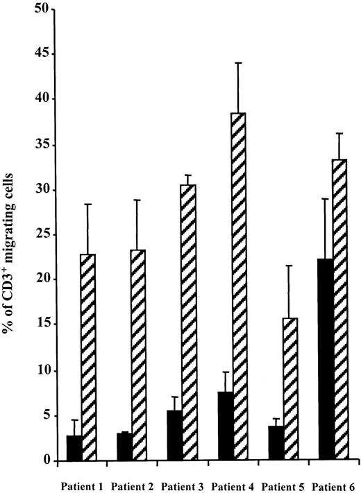 Fig. 1. SDF-1–induced chemotaxis is impaired in WAS CD3+ lymphocytes. / The migration of PBMCs from normal donors or WAS patients in response to SDF-1 (300 ng/mL) was studied in a Transwell assay. Data representing the percentage of migrating CD3+ cells are expressed as the mean of triplicate ± SE. No differences were observed between patients' and controls' CD3+ cells in the absence of SDF-1 (range 0.3%-0.5% migrating cells) (not shown). (▪), patients; (▨), normal donors.
