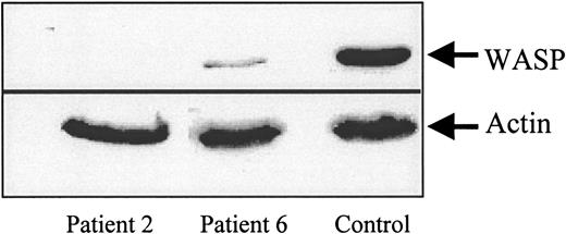Fig. 2. Western blot analysis of WASP in blood lymphocytes of patients no. 2 and 6 and normal donor (control). / Protein extracts (40 μg) from patients no. 2 and 6 or from a normal donor T lymphocytes were separated by SDS-PAGE followed by transfer to PVDF membranes. Actin and WASP were detected using a monoclonal anti-WASP antibody (a gift from D. Nelson) and a monoclonal anti-β actin antibody (Sigma), respectively, and immunoreactive bands were visualized using an ECL detection system.
