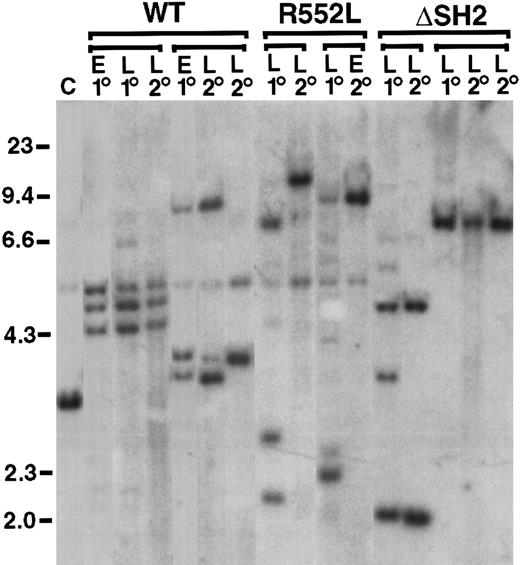 Fig. 4. Oligoclonal disease in primary mice with p190-induced B-lymphoid leukemia, with clonal restriction in secondary recipients. / Genomic DNA from lymphoblasts from pleural effusion (E) or lymph node (L) from a primary diseased animal (1°) or secondary transplant recipients of lymph node-derived lymphoblasts (2°) were digested withBglII and hybridized with a radioactive probe from the neomycin resistance gene. Groups of primary and secondary recipients are indicated by brackets; in some cases, 2 different secondary recipients of the same primary leukemia are shown. Tumor cell DNA from secondary transplant recipients often contained only a subset of the proviral clones observed in the primary tumor, suggesting that secondary transplantation selects for growth of particular clones, perhaps reflecting continued evolution of p190-transformed lymphoid cells to a more aggressive state. Control DNA (C) from a cell line containing a single BCR/ABL provirus is on the left, as are molecular size markers in kilobases (kb).