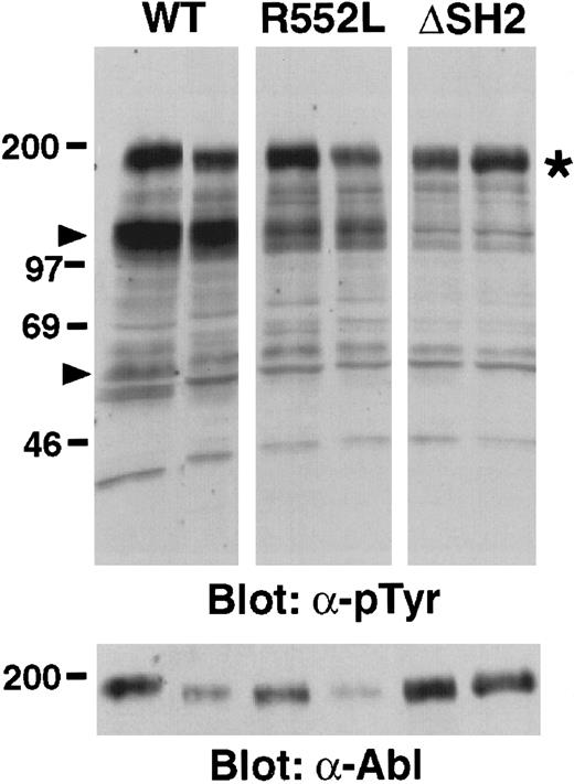 Fig. 5. Decreased in vivo tyrosine kinase activity of p190. / BCR/ABL SH2 mutants. Proteins from malignant pleural effusion-derived lymphoblasts from 2 different primary recipients of marrow transduced with p190 BCR/ABL wild-type (WT), R552K, or ΔSH2 were blotted with monoclonal antibodies against phosphotyrosine (upper panel) or Abl (bottom panel). Equal amounts of protein were loaded in each lane by Ponceau-S staining of the membrane, and equivalent amounts of p46 and p52 Shc proteins were detected in each lane after immunoblotting with anti-Shc antibodies (data not shown). Molecular size markers (kd) are at left. Arrowheads indicate the position of p110-120 and p62 proteins whose tyrosine phosphorylation is greatly decreased in the SH2 mutant-transduced cells. The position of Bcr/Abl is indicated by the asterisk. The decreased size of the p190 ΔSH2 protein (about 1 kd) is not apparent under these conditions.