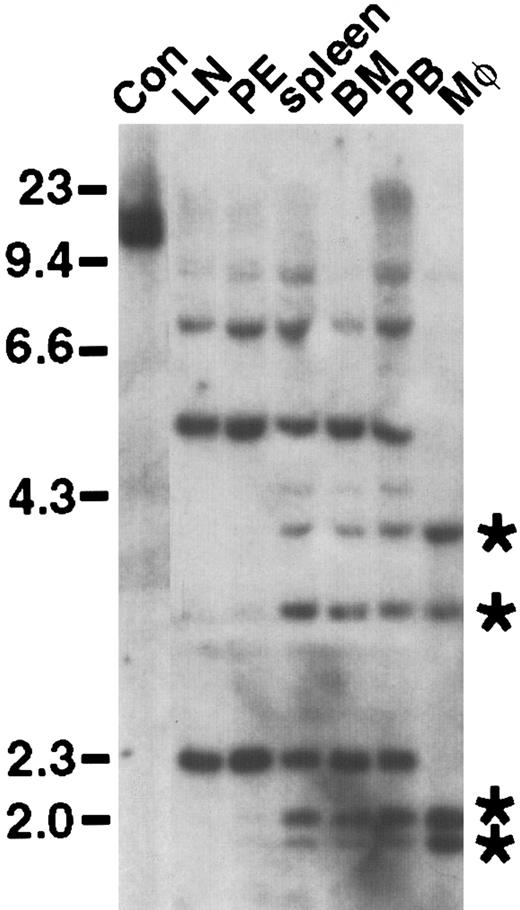 Fig. 8. Distinct target cells for p210 ΔSH2-induced CML-like disease and B-lymphoid leukemia. / Genomic DNA from the indicated hematopoietic tissues and lineages (LN, lymph node; PE, pleural effusion; BM; bone marrow; PB, peripheral blood; Mφ, macrophages) from an animal with simultaneous CML-like disease and B-lymphoid leukemia was digested withBglII and hybridized with a radioactive probe from the neomycin resistance gene. Control DNA (Con) from a cell line containing a single BCR/ABL provirus is in the first lane on the left. DNA size markers (in kb) are at left, whereas the positions of 4 unique proviral clones in peripheral blood neutrophils and peritoneal macrophages are indicated by asterisks at the right.