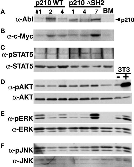 Fig. 10. No qualitative defect in activation of signaling pathways in primary myeloid cells expressing p210 ΔSH2. / Western blotting with the indicated antibodies was performed on extracts from myeloid cells isolated from mice with p210 wild-type–induced (left side) or p210 ΔSH2-induced (right side) CML-like disease. As controls, extract from untransduced Balb/c bone marrow (BM) and from NIH 3T3 cells without (−) and with (+) stimulation with PDGF were included at the far right. Equivalent amounts of total protein were present in each lane as judged by Ponceau S staining of the membrane. (A) Anti–C-terminal Abl antibody. (B) Anti-c-Myc antibody. (C) Antiphospho-STAT5 (top) and anti-STAT5A (bottom). (D) Anti-phospho-Akt (top) and anti-pan-Akt (bottom). (E) Anti-phospho-ERK (top) and anti-pan-ERK (bottom). Both p42 and p44 ERK are detected. (F) Anti-phospho-JNK (top) and anti-pan-JNK (bottom). Both p46 and p54 JNK are detected.