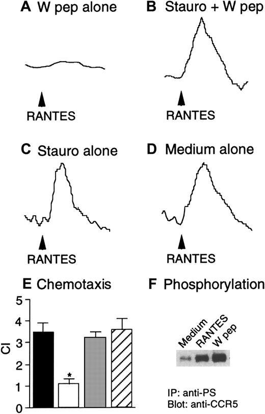 Fig. 3. Heterologous desensitization of CCR5 and the effect of staurosporine. / Hos/CD4/CCR5/FPRL1 cells were preincubated in the absence (A) or presence (B) of staurosporine (1.4 ng/mL) at 37°C for 1 hour, followed by treatment with W peptide (1 μM) at 37°C for an additional 60 minutes. Ca++ flux in response to RANTES (50 ng/mL) was measured. Hos/CD4/CCR5/FPRL1 cells were preincubated with (C) or without (D) staurosporine (1.4 ng/mL) at 37°C for 1 hour, and RANTES-induced Ca++ flux was then measured. (E) Hos/CD4/CCR5/FPRL1 cells were preincubated at 37°C with medium, W peptide (1 μM, 1 hour; W pep), staurosporine (1.4 ng/mL, 1 hour) followed by W peptide (1 μM, 1 hour; Stauro+Wpep), or staurosporine alone (1.4 ng/mL, 1 hour; Stauro alone). After washing, cell migration in response to RANTES (50 ng/mL) was measured. The asterisk indicates a significantly reduced cell migration after W peptide treatment, compared with cells treated with medium only (medium). ▪ indicates medium; ■, W pep; ░, stauro + W pep; ▨, stauro alone. (F) Hos cells expressing CD4/CCR5/FPRL1 were treated at 37°C with RANTES (1 μg/mL, 1 minute) or W peptide (1 μM, 60 minutes). The cell lysates were detected for CCR5 phophorylation by using an antiphosphoserine antibody (anti-PS) for immunoprecipitation (IP) followed by immunoblot with anti-CCR5 antibody.