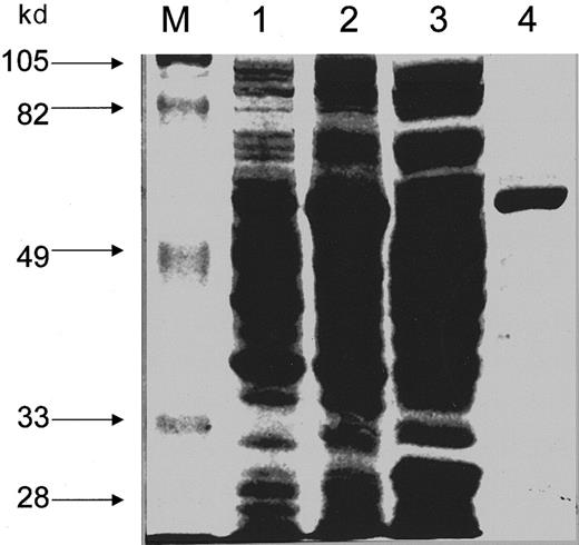 Fig. 1. SDS-PAGE analysis of the wild-type ALAD-GST fusion protein. / Expression and purification of GST-ALAD fusion protein and SDS-PAGE were carried out as described in “Materials and methods.” One percent (v/v) of the total volume was loaded to each lane. Proteins were stained with Coomassie brilliant blue. Lane M: molecular weight protein standards; lane 1: transformed E coli PLysS cells without induction; lane 2: transformed E coli PLysS cells after induction with IPTG; lane 3: supernatant from the lysate of induced cells; lane 4: GST-fusion protein purified by glutathione-affinity chromatography.