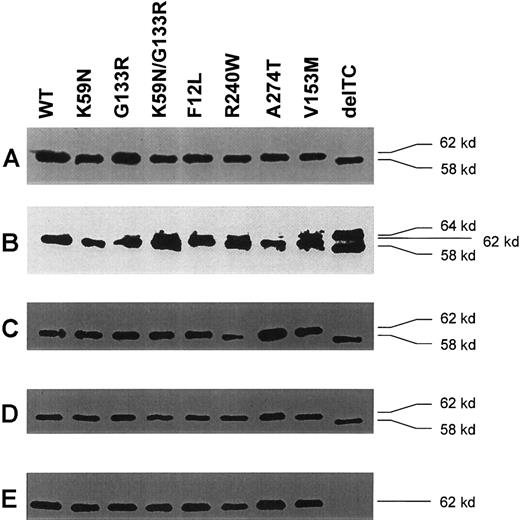 Fig. 2. Immunoblot analysis of GST-ALAD fusion proteins. / (A) Immunoblot analysis with MAb anti-GST. The molecular size of the wild type and mutants were 62 kd, except for delTC, which was 58 kd, indicating that ALAD expressed by delTC is shorter than the wild-type ALAD by about 4 kd. (B) Immunoblot analysis with rabbit IgG against antihuman ALAD. Essentially similar results are seen as in panel A, except for the presence of an additional band at about 64 kd, including delTC. This finding suggests that the additional band is likely due to a nonspecific binding of a bacterial protein with IgG. (C) Immunoblot analysis with mouse MAb4. Results are essentially similar to row A. (D) Immunoblot analysis with mouse MAb350. Results are essentially similar to row A. (E) Immunoblot analysis with mouse MAb330. In contrast to polyclonal IgG, MAb4 and MAb350, MAb330 completely failed to recognize delTC.