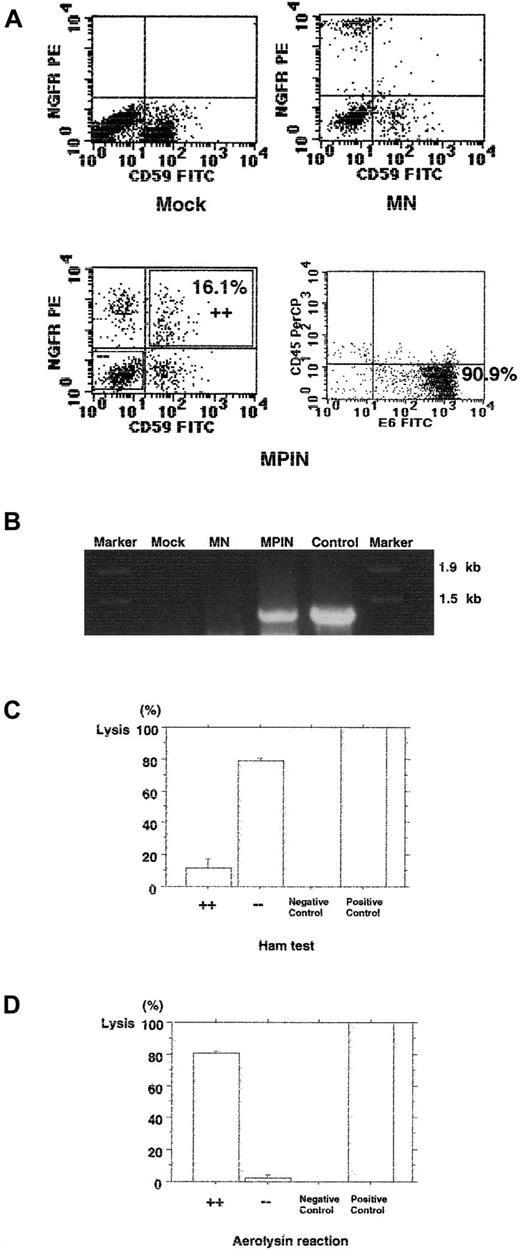 Fig. 5. Gene transfer by MPIN into PNH-phenotype primary erythroid cells from a patient with PNH restores PIG-A function and resistance to hemolysis. / (A) GPI-AP (CD59), NGFR, E6, and CD45 surface expression of MPIN-transduced erythroid cells generated from GPI-AP−(CD59−) BMMCs on day 12. (B) Detection of the region including PIG-A in MPIN-transduced BMMCs by PCR. DNA was isolated from transduced (MN or MPIN) or untransduced (mock) BMMCs. A region including vector plus 5′ PIG-A was amplified by PCR. For positive control, the MPIN vector plasmid was used as a template, and Marker 6 was loaded as a marker. (C) (D) Small-scaled Ham test (panel C), and aerolysin assay (panel D). The percentage of lysis of CD59+NGFR+ (+ +) and CD59−NGFR− (− −) cells from MPIN-transduced BMMCs were compared. For 100% lysis, water was used in place of serum, and for 0% lysis, heat-inactivated serum was used. Results are shown as mean ± SE.