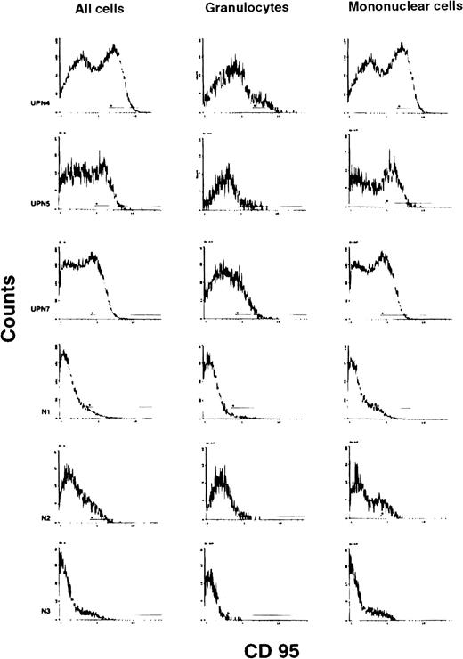 Fig. 4. Fas expression on marrow granulocytes and mononuclear cells. / Representative histograms of Fas expression on marrow cells from 3 patients with Shwachman-Diamond syndrome and 3 control subjects, showing larger populations especially of mononuclear cells expressing Fas in the patients.