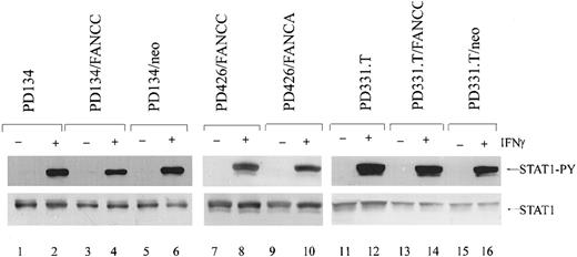 Fig. 4. Normal phosphorylation of STAT1 in mature FA-C fibroblasts. / Immunoblot analysis of human FA-C fibroblasts by means of an antibody specific for phosphorylated STAT1 demonstrates that STAT1 is phosphorylated equivalently between mutant and corrected IFNγ-stimulated cells (1 ng/mL IFNγ) (top panel). In addition, total STAT1 is expressed at approximately equal levels (bottom panel).