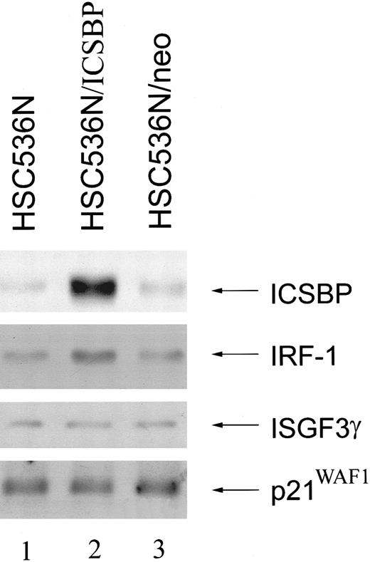 Fig. 7. Enforced expression of ICSBP fails to down-regulate IRF-1 ISGF3γ or p21WAF1. / Immunoblot analysis of FA-C B lymphoblasts HSC536N (lane1), HSC536N transduced with the human ICSBP cDNA (HSC536N/ICSBP) (lane2), and HSC536N transduced with vector alone (HSC536N/neo) (lane 3) demonstrates that HSC536N/ICSBP are expressing high constitutive levels of ICSBP, but this expression fails to suppress IRF-1, ISGF3γ, or p21WAF1.