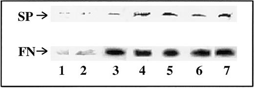 Fig. 4. Co-migration of SP and FN from the sera of patients with BM fibrosis. / Sera were immunoprecipitated with anti-SP and then developed sequentially for SP and FN in Western blot. Details of the techniques are described in “Materials and methods.” Representative blots of different categories of patients are shown. Lane 1, PV; lanes 2 and 3, ET; lanes 4 and 5, IMF; lanes 6 and 7, CML. No band for SP was observed in patients without BM fibrosis.