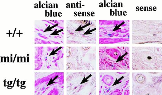Fig. 1. Expression of NDST-2 mRNA by +/+ and. / tg/tg skin mast cells but not bymi/mi skin mast cells. A section of +/+,mi/mi, or tg/tg skin was stained with alcian blue and nuclear fast red, and the adjacent section was hybridized with the antisense probe for the NDST-2 gene. Another section of +/+,mi/mi, or tg/tg skin was stained with alcian blue and nuclear fast red, and the adjacent section was hybridized with the sense probe for the NDST-2 gene. Identical mast cells in the pairing sections are shown by arrows (original magnification × 400).
