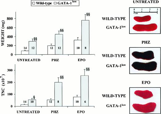 Fig. 1. General features of the spleens from adult (6 to 12 months of age) GATA-1low and wild-type mice. / Photographic picture (on the right), weight (top on the left) and total number of cells (TNC, bottom on the left) of spleens from untreated (intact), day-3 PHZ-treated, and day-6 EPO-treated wild-type (white bars) and GATA-1low (gray bars) mice. The values are reported as the mean ( ± SD) of replicate measures. The number on each bar indicates the number of mice analyzed for that experimental group. The values observed in the GATA-1low mice are statistically different from those observed in the corresponding wild-type animals. §P < .05; §§P < .01.