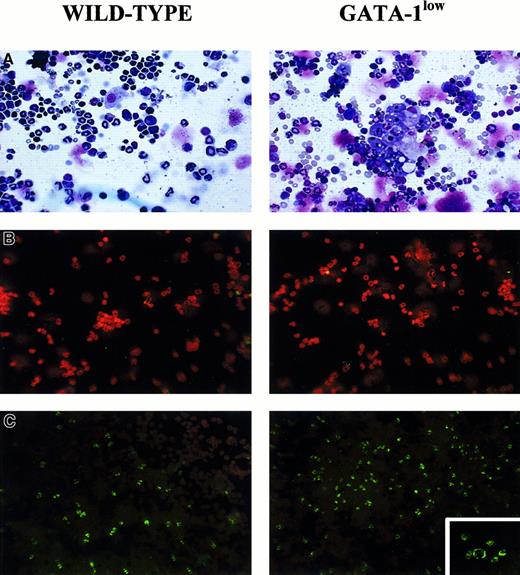 Fig. 2. Staining of cytocentrifuged preparations of marrow cells harvested from GATA-1low (right) and normal (left) littermates. / (A) May-Grünwald staining; 25 × magnification. (B) Propidium iodide staining (negative controls); 25 × magnification. (C) TUNEL staining; 25 × magnification except for the small insert of the GATA-1low mice, which is 40 × to show the prevalent perinuclear localization of the DNA breaks in the TUNEL-positive cells.