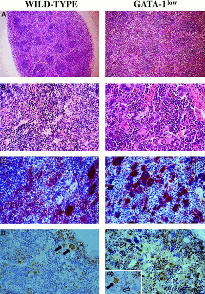 Fig. 3. Immunohistochemical analysis of spleens obtained from wild-type (left panels) and GATA-1low (right panels) mice. / (A) (B) Hematoxilin-eosin staining of paraffin-embedded sections; 10 × and 40 × magnification. (C) (D) 4A5-specific immunostaining (panel C). GATA-1–specific immunostaining (panel D). The black and white arrows identify representative GATA-1+ or GATA-1− megakaryocytes, respectively, while the small arrows identify representative GATA-1+ erythroblasts. The small insert in the GATA-1low panel shows the GATA-1 staining of a splenic section from a representative heterozygote female, as a control. There is 40 × magnification in all cases.