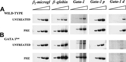 Fig. 5. Semiquantitative RT-PCR analysis of the expression of β2-microglobulin (as control), of β-globin, and of the total (GATA-1), proximal (GATA-1p), and distal (GATA-1d) GATA-1 transcripts in the spleens of untreated or day-1 PHZ-treated wild-type and GATA-1low mice. / Each product was analyzed for increasing numbers of cycles as indicated by a triangle on the top of the panels. In particular, the products were analyzed after 18, 21, 24, and 27 cycles for β2-microglobulin; 15, 18, 21, and 24 cycles for β-globin; 20, 24, 26, and 30 cycles for the total GATA-1 transcripts; and 20, 25, 30, and 35 cycles for the GATA-1p and GATA-1d transcripts. The failure of the amplification of transcripts originating from the distal (or testis) GATA-1 promoter28 with the use of cDNA prepared from the GATA-1low spleens represents an indirect control of the genotype of the mutant mice analyzed in this study. Similar results were obtained in 3 additional experiments.