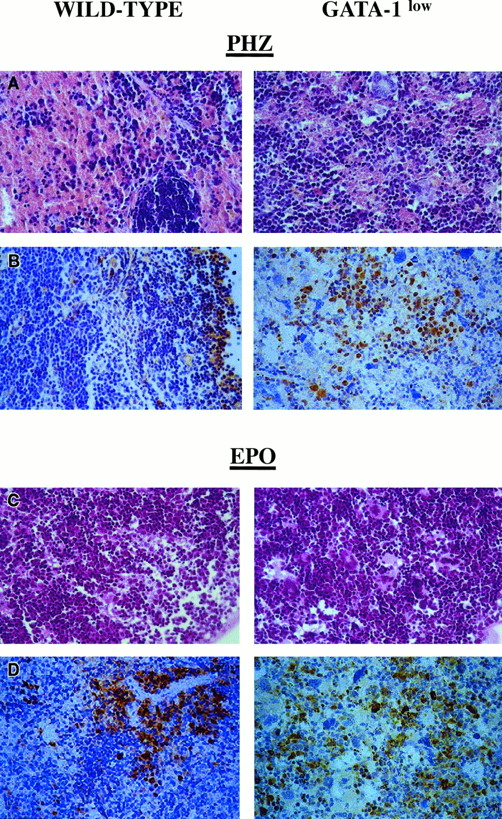 Fig. 9. Immunohistochemical analysis of spleens obtained from day-1 PHZ-treated (top panels) or day-6 EPO-treated (bottom panels) wild-type and GATA-1low mice, as indicated. / Hematoxilin-eosin staining and anti–GATA-1–specific immunostaining are presented in the left and right panels, respectively (40 × magnification).