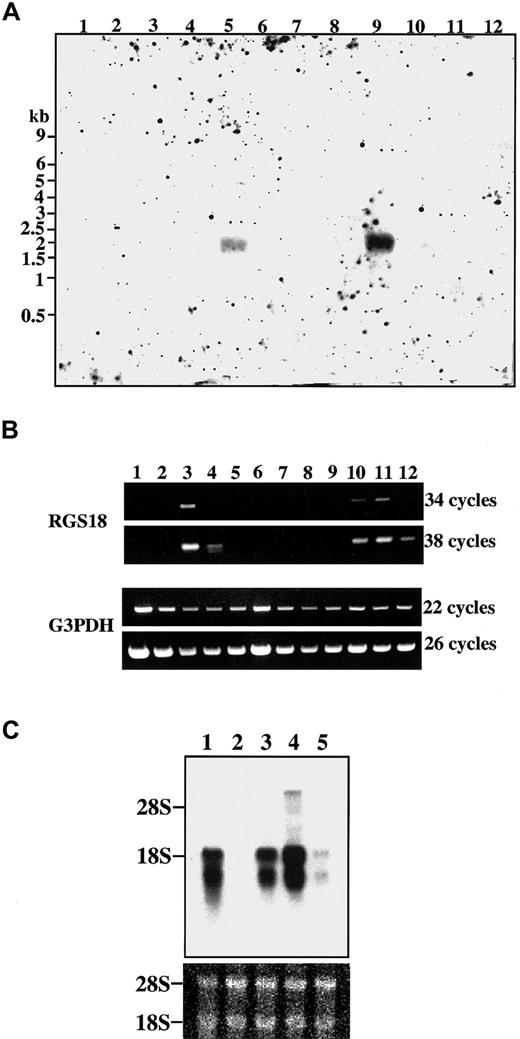Fig. 3. Expression of RGS18 mRNA in mouse tissues and hematopoietic cells. / The filters were hybridized with the DIG-labeled RGS18 cDNA probe. (A) Northern blot analysis of RGS18 in various mouse tissues. Two micrograms of polyA+ mRNAs from the mouse tissues were loaded on the blots: brain (lane 1), heart (lane 2), kidney (lane 3), liver (lane 4), lung (lane 5), skeletal muscle (lane 6), skin (lane 7), small intestine (lane 8), spleen (lane 9), stomach (lane 10), testis (lane 11), and thymus (lane 12). Sizes of mRNA standards in kilobases (kb) are shown at left. (B) Detection of RGS18 by RT-PCR in various mouse tissues. The cDNAs prepared from various mouse tissues were used as templates for PCR. Upper panel: RGS18; lower panel: G3PDH. PCR was performed in 34 and 38 cycles for RGS18, and 22 and 26 cycles for G3PDH. Heart (lane 1), brain (lane 2), spleen (lane 3), lung (lane 4), liver (lane 5), skeletal muscle (lane 6), kidney (lane 7), testis (lane 8), 7-day embryo (lane 9), 11-day embryo (lane 10), 15-day embryo (lane 11), and 17-day embryo (lane 12). (C) Northern blot analysis of various mouse hematopoietic cell lines. Five micrograms of polyA+mRNAs were loaded on the blots: Ba/F3 cells (lane 1), CTLL-2 cells (lane 2), WEHI-3B cells (lane 3), FD-TPO cells (lane 4), and SKT6 cells (lane 5). Equal loading and integrity of the mRNA samples was confirmed by ethidium bromide staining of the ribosomal RNA bands (bottom panel).