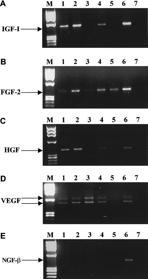 Fig. 3. RT-PCR analysis of mRNA expression for various growth factors by CD34+ cells. / IGF-1 (A), FGF-2 (B), HGF (C), VEGF (D), and NGF-β (E). Lane 1, purified BM CD34+ cells; lane 2, BFU-E–derived cells; lane 3, CFU-GM–derived cells; lane 4, CFU-Meg–derived cells; lane 5, platelets; lane 6, stromal cells; lane 7, negative control of RT-PCR reaction (H2O instead of mRNA). The data are representative of 4 to 8 experiments using cells separated from different donors.
