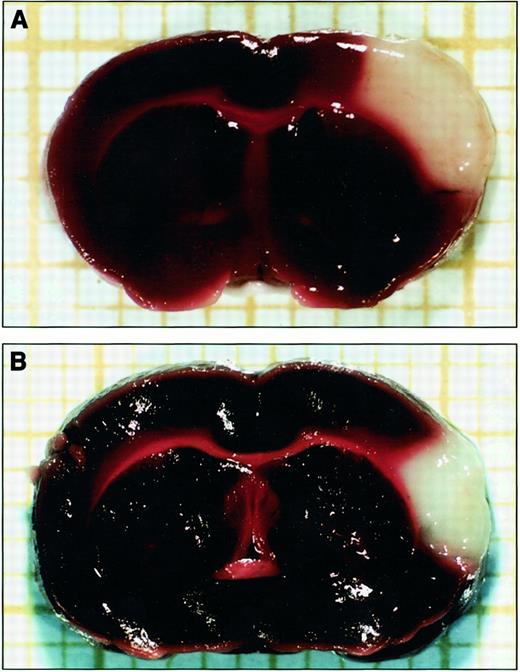 Fig. 1. TTC-stained brain sections. / (A) BALB/c mouse. (B) Pfd Gold hamster. The injured area is identified as the unstained (white) area surrounded by stained (brick red) area.