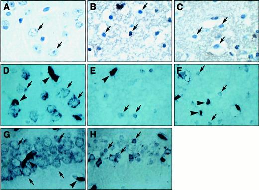 Fig. 2. Histologic analysis of laminin and fibrin(ogen) staining in BALB/c mice. / (A-C) Sections stained for fibrin(ogen) (brown) followed by hematoxylin (dark blue); (A) contralateral area of cerebral cortex with normal neuronal morphology (arrow) and diffuse fibrin(ogen) staining, which were comparable in the saline-treated and Pli-treated groups; (B,C) area of FII in saline-treated (B) and Pli-treated (C) mice. Neuronal morphology (arrows) and fibrin(ogen) staining are similarly affected in the saline-treated and Pli-treated groups. (D,H) Sections stained for laminin (dark blue); (D) contralateral area of cerebral cortex with strong immunoreactivity in basal lamina of vessels (arrowheads) and with immunoreactivity surrounding neurons (arrows), which were comparable in the saline-treated and Pli-treated groups; (E,F) area of FII in saline-treated (E) and Pli-treated (F) mice. The immunoreactivity of neurons (arrows) and vessels (arrowheads) in the infarct area was comparably reduced in both groups. Likewise, the immunoreactivity in neurons was reduced in the CA1 region of the hippocampus following injection of 1.5 nM kainic acid (H, arrows), relative to the contralateral side (G, arrows).