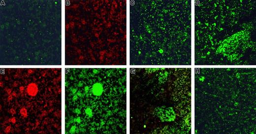 Fig. 1. Stx1 uptake and activation of platelets. / (A) Unstimulated human platelets in medium incubated with monoclonal anti-Stx1 and goat-antimouse immunoglobulin FITC. No FITC labeling observed. (B) Same as in panel A, counterstained with mouse-antihuman CD41–PE to identify platelets. (C, D) Platelets incubated for 2 hours with 10 pg/mL Stx1 (C) or 10 ng/mL Stx1B (D). FITC labeling noted in cells. (E) Platelet aggregates forming after incubation with 100 pg/mL Stx1 labeled with mouse-antihuman CD41-PE (to identify platelets). (F) Platelet aggregates containing Stx1-FITC after incubation with 100 pg/mL Stx1 (same as panel E, labeled for Stx1). (G) Platelet aggregates containing Stx1B-FITC after incubation with 10 pg/mL Stx1B (combined labeling for FITC-Stx1 and anti-CD41–PE). (H) Preincubation of Stx1B (final concentration, 10 pg/mL; see “Patients, materials, and methods”) with anti-Stx1 inhibited the uptake of Stx1B and the formation of aggregates (FITC-Stx1 staining). (A-H) Magnification, × 400.