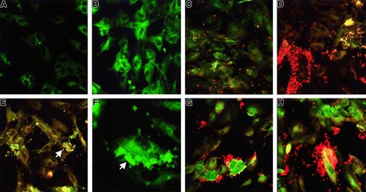 Fig. 3. Platelet binding and aggregation on TNF-α–prestimulated HUVECs. / (A) Unstimulated (ie, not incubated with Stx) HUVECs incubated with monoclonal anti-Stx1 and goat-antimouse immunoglobulin FITC. No FITC labeling observed. (B) HUVECs incubated for 2 hours with 100 pg/mL Stx1. Stx1-FITC labeling noted in cells. (C) HUVECs incubated with platelets without Stx1. Scattered platelets noted. (D) HUVECs incubated with 100 pg/mL Stx1 and platelets. Platelet aggregates containing Stx1-FITC and platelet binding to HUVECs noted (panels C and D show combined staining FITC-Stx and anti CD41-PE). (E) HUVECs incubated with 1 ng/mL Stx1 and platelets showing platelet binding to the circumference of HUVEC (see arrow, FITC-Stx and anti CD41-PE). (F) HUVECs incubated with 100 pg/mL Stx1 and platelets. Arrow shows platelet aggregate containing Stx1-FITC binding to HUVEC. (G, H) HUVECs incubated with 100 pg/mL (G) or 10 pg/mL (H) Stx1B and platelets showing uptake of Stx1B in both cell types, aggregation of platelets, and binding to HUVECs (FITC-Stx and anti-CD41–PE). Magnifications: A-E and G-H, × 400; F, × 1300.