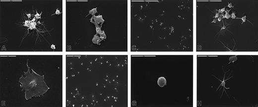 Fig. 4. Stx1-induced changes in platelet ultramorphology. / Platelet aggregates were formed after incubation with 10 pg/mL (A), 100 pg/mL (B), 1 ng/mL (C, D) Stx1. Long pseudopodia were noted (A, B, D), and highly activated platelets flattened and adhered firmly to the glass (E, Stx1 100 pg/mL). Panels F, G, and H show unstimulated platelets that are round, discoid, or elongated and do not aggregate.