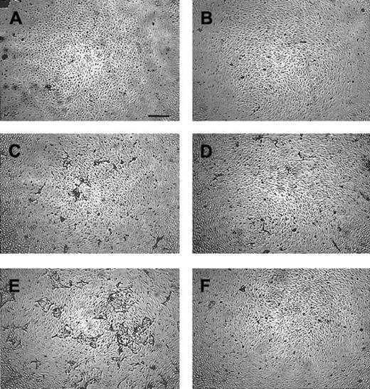 Fig. 1. Effect of the MMP inhibitors BB94 and BB3103 on the induction of capillary-like tube formation by hMVECs in 3-dimentional fibrin matrices. / The hMVECs were cultured on top of a 3-dimensional fibrin matrix in M199 supplemented with 10% human serum and 10% NBCS and stimulated without (A,B) or with the combination of 10 ng/mL bFGF and 10 ng/mL TNF-α (C-F) in the absence (C,D) or the presence of 5 μg/mL BB94 (E,F). Simultaneous addition of 30 μg/mL neutralizing polyclonal anti–u-PA antibodies (B,D,F) inhibited tube formation by 87%. The nonphase contrast photos were taken after 7 days of culture (bar represents 500 μm) and are representative of 3 independent experiments.