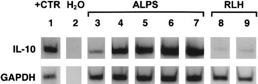 Fig. 5. Relative IL-10 and GAPDH mRNA content in patient tissues. / Shown are autoradiographs of gels containing radiolabeled IL-10 (upper panel) and GAPDH (lower panel) cDNAs prepared by RT-PCR on tissue extracts. Lane 1 shows IL-10 cDNA and GAPDH cDNA in IL-10–producing positive control cells. Lane 2 shows the result of an RT-PCR reaction on water without added cell RNA extracts. Lanes 3 to 7 show RT-PCR products from tissues of 5 ALPS patients. Lanes 8 and 9 show products of reactions with RNAs from tissues showing reactive lymphoid hyperplasia (RLH). The relative GAPDH signals (lower panel) are similar for all specimens, but the IL-10 signals (upper panel) are markedly more intense for ALPS specimens.