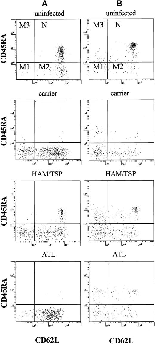 Fig. 1. Flow cytometric analysis of PBMCs. / Representative data of PBMCs from one patient with ATL, one patient with HAM/TSP, and one HTLV-I carrier. PBMCs were stained by PC5-labeled anti-CD4 (A), anti-CD8 (B), FITC-labeled anti-CD45RA, PE-labeled anti-CD62L. Naive T cells (N) were CD45RA+ and CD62L+, and memory T cells can be divided into 3 groups (M1, M2, and M3).